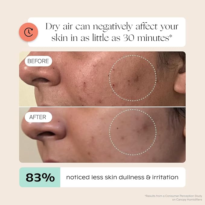 Canopy Bedside Humidifier 2.0, Moonstruck, 36 HR Run Time, 2.5L Capacity - Reading Light & White Noise - Alleviate Symptoms of Allergies, Cold, Dry Skin - Humidifier, Filter, Power Cord & Adapter