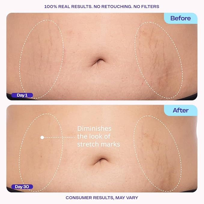 goPure Tighten & Smooth Belly Cream - Clinically Tested